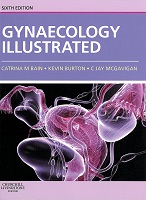 Gynaecology illustrated