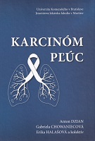 Karcinóm pľúc