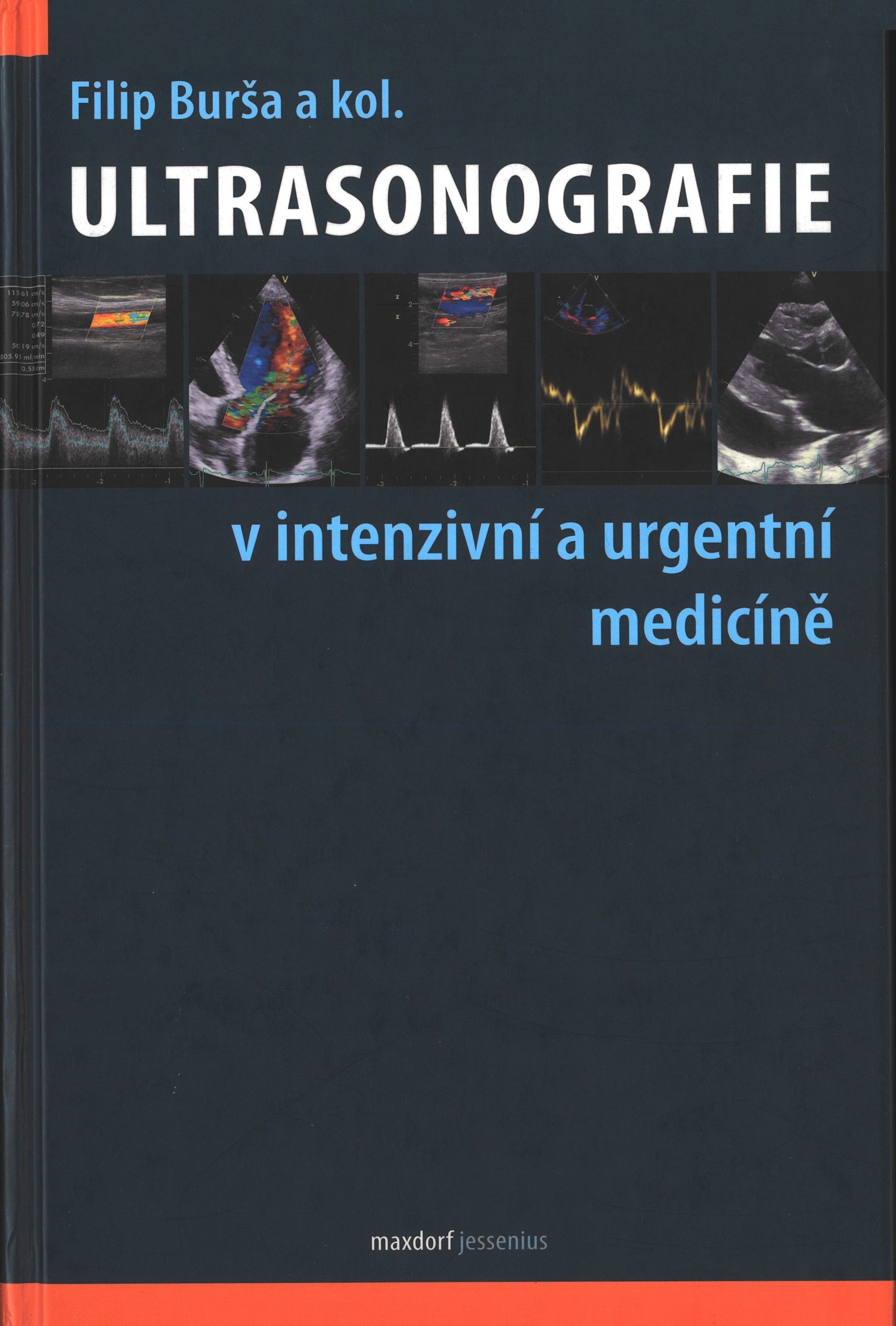 Ultrasonografie v intenzivní a urgentní medicíně